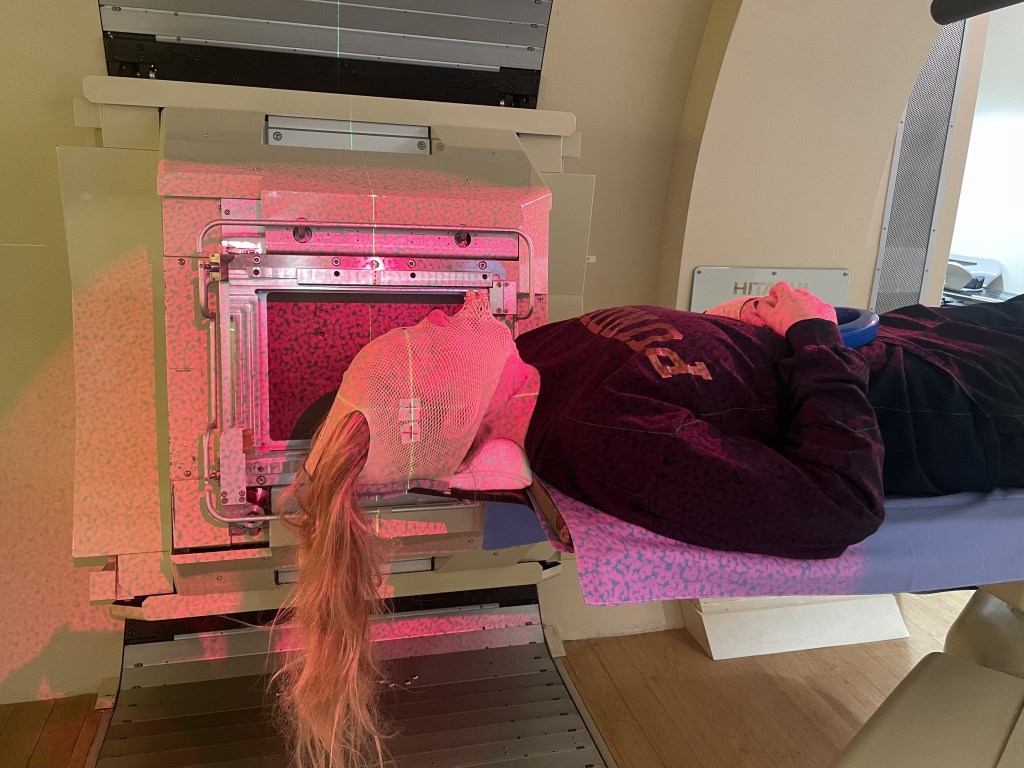 Proton Radiation era